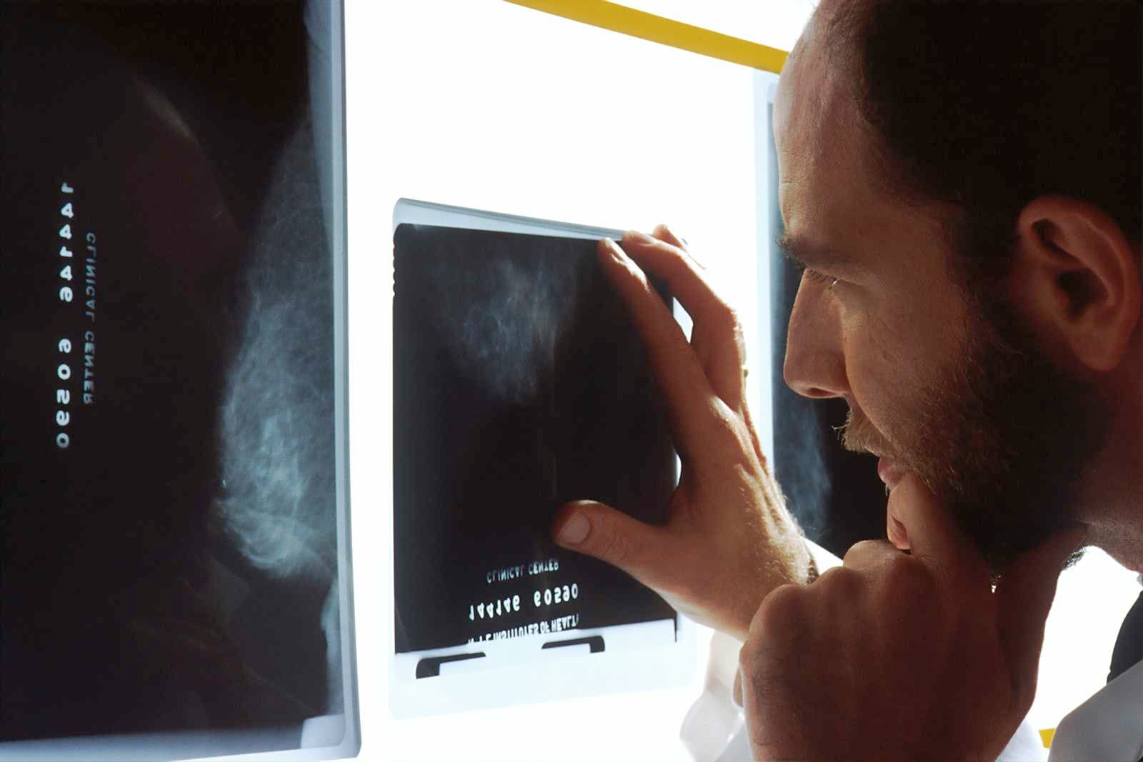 Medical Imaging for Early Cancer Detection